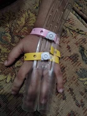 Fingers Appliance